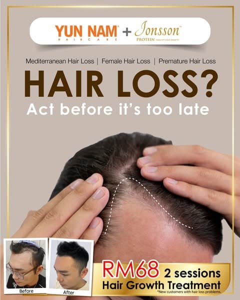 Noticing more hair fall lately? Now is the best time to take action before it worsens 💇‍♂️⚠️