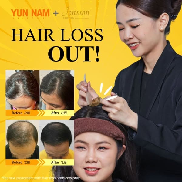 Hair fall can begin earlier than many people expect even in your 20s 😮‍💨⚠️